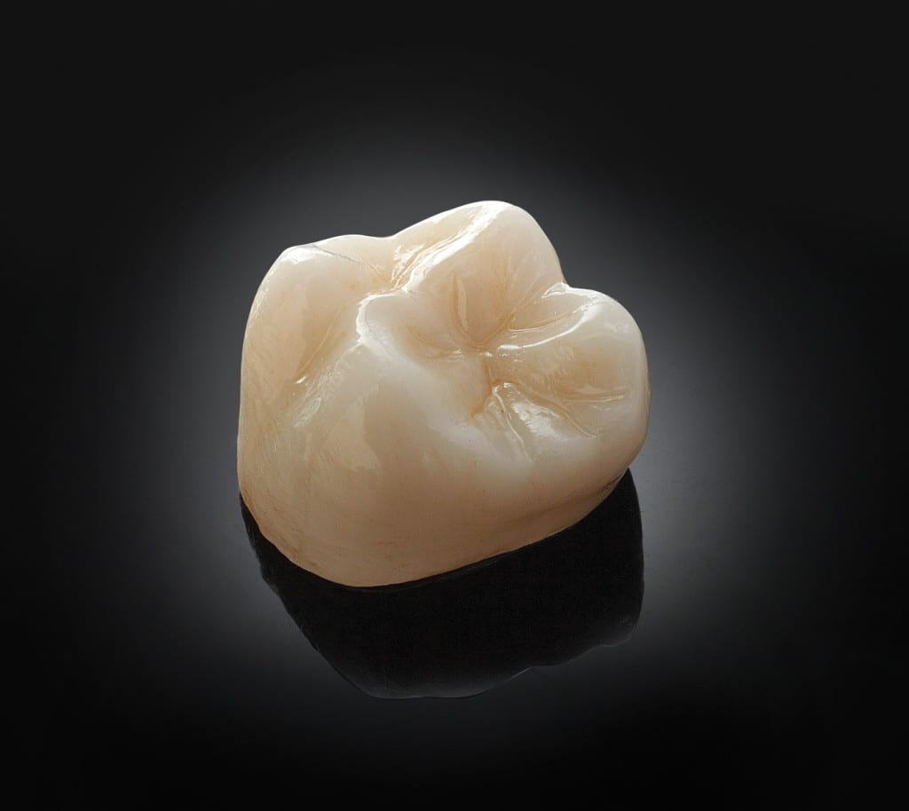 The Revolutionary Zirconia Crown