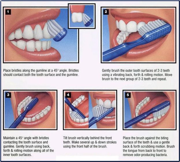 Brushing Techniques from MDG